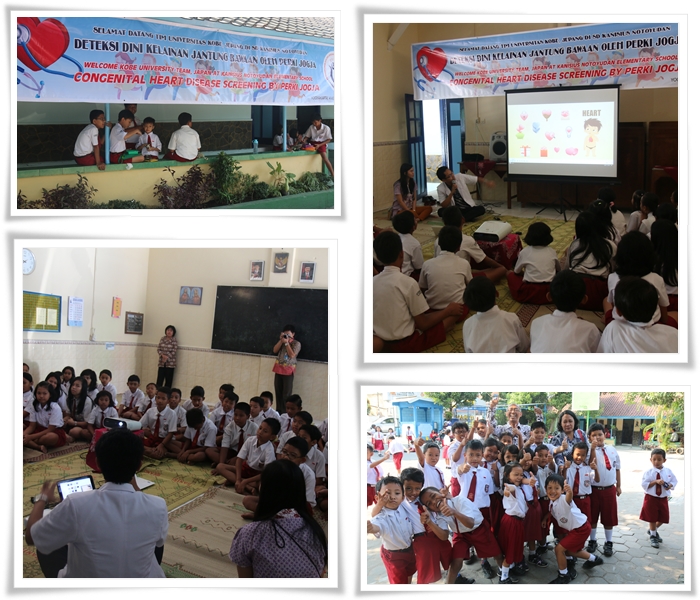 Pemeriksaan Deteksi Dini  Atrial Septal Defect (ASD) RSUP Dr Sardjito - FK UGM & Kobe University Jepang