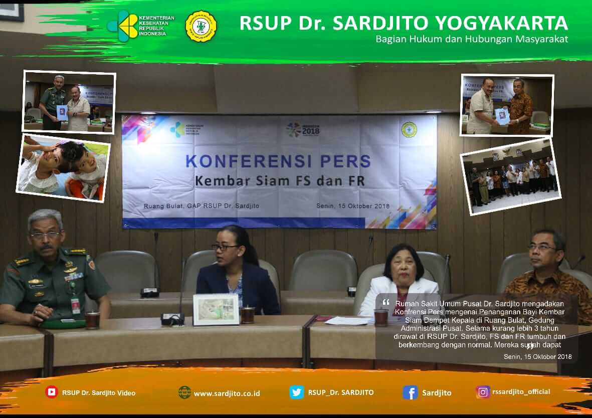 RSUP Dr. Sardjito Tangani Kembar Siam Dempet Kepala