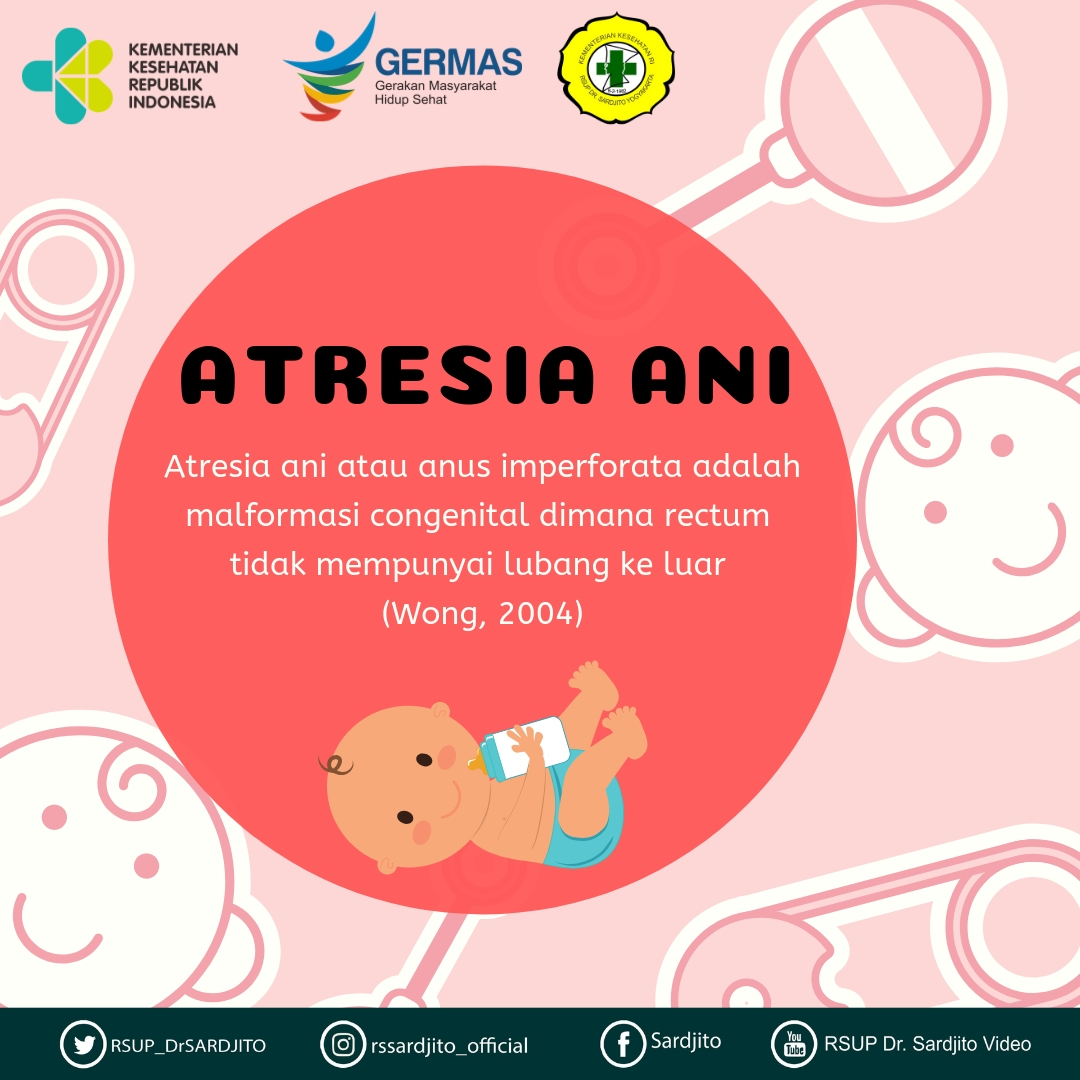 Kenali Penyakit Atresia Ani Sejak Dini