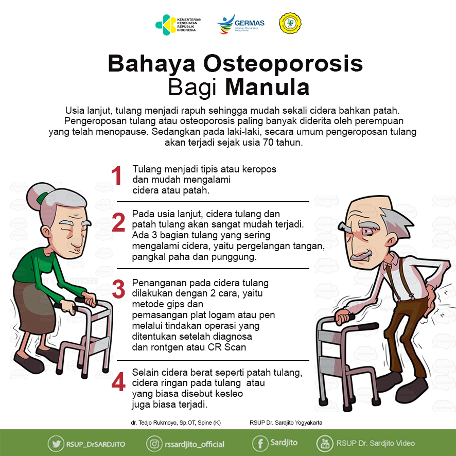 Bahaya Osteoporosis Bagi Manula