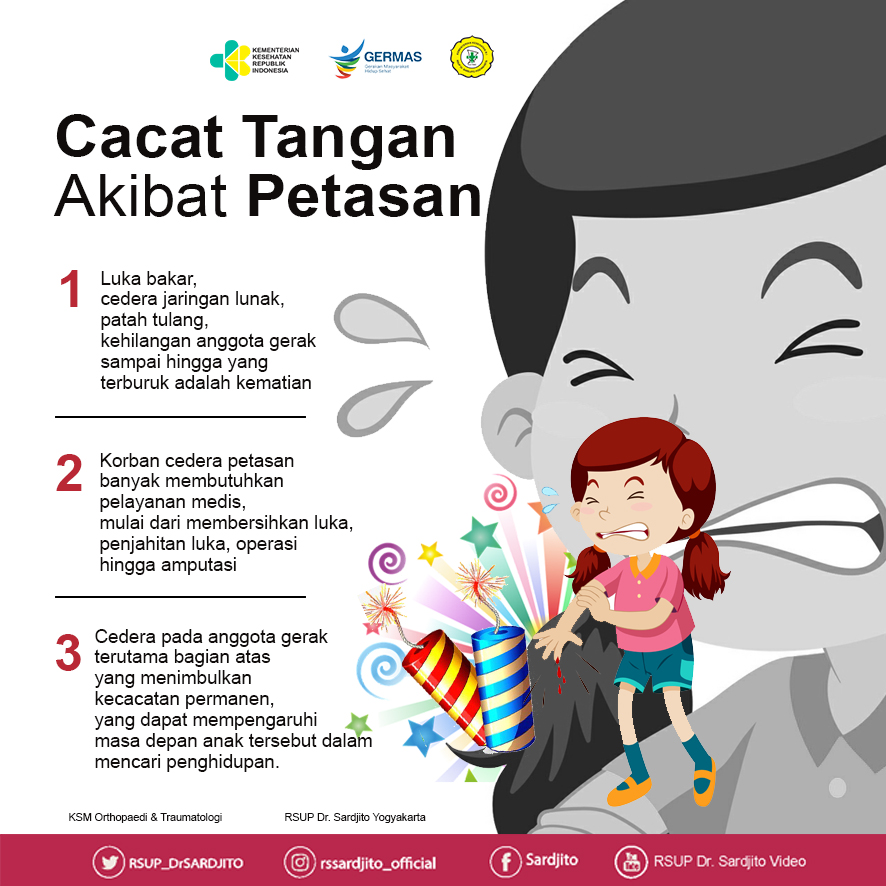 Cacat Tangan Akibat Petasan