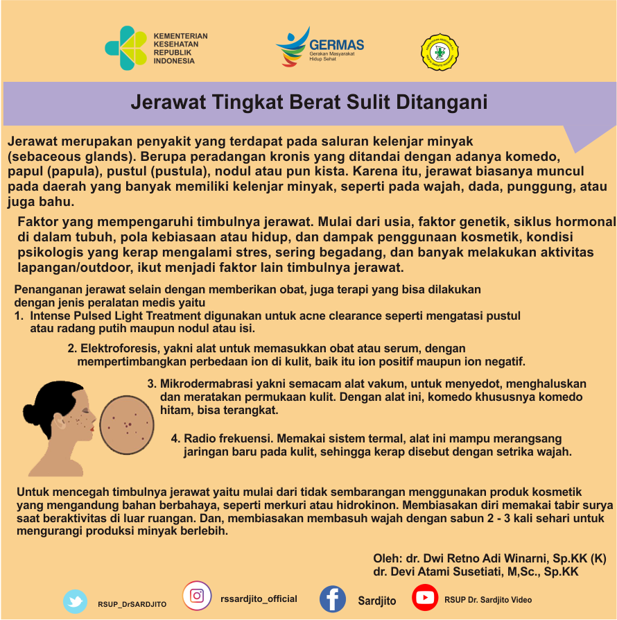 Jerawat Tingkat Berat Sulit Ditangani
