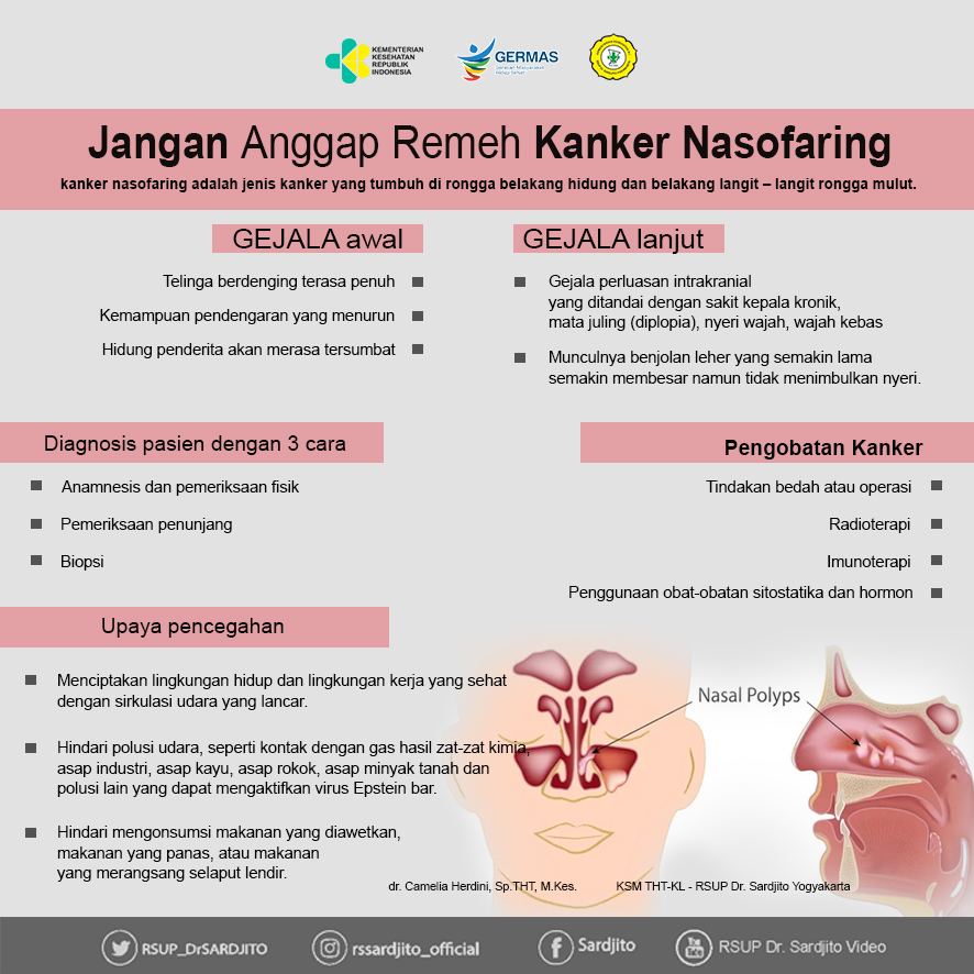 Jangan Anggap Remeh Kanker Nasofaring