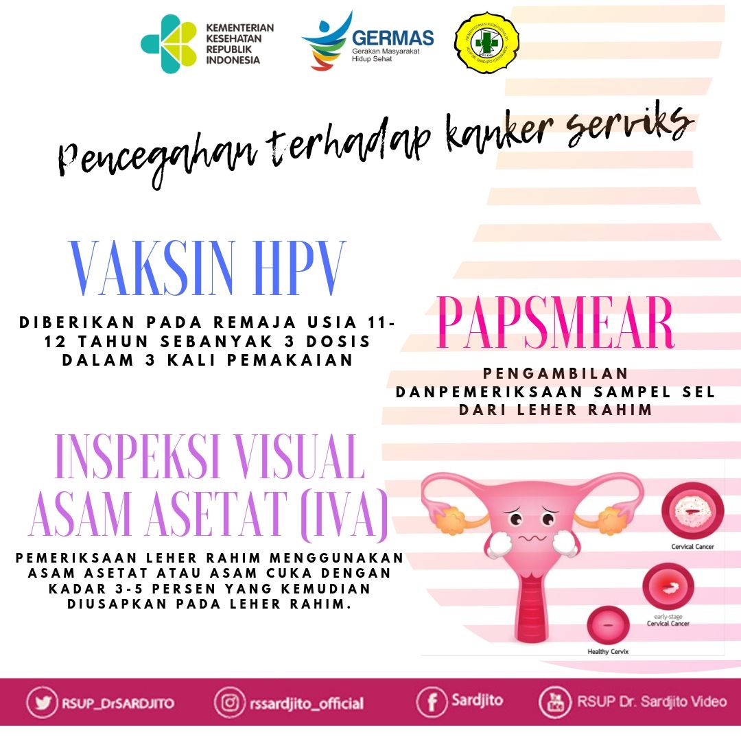 Pentingnya Screening Kanker Serviks Sejak Dini