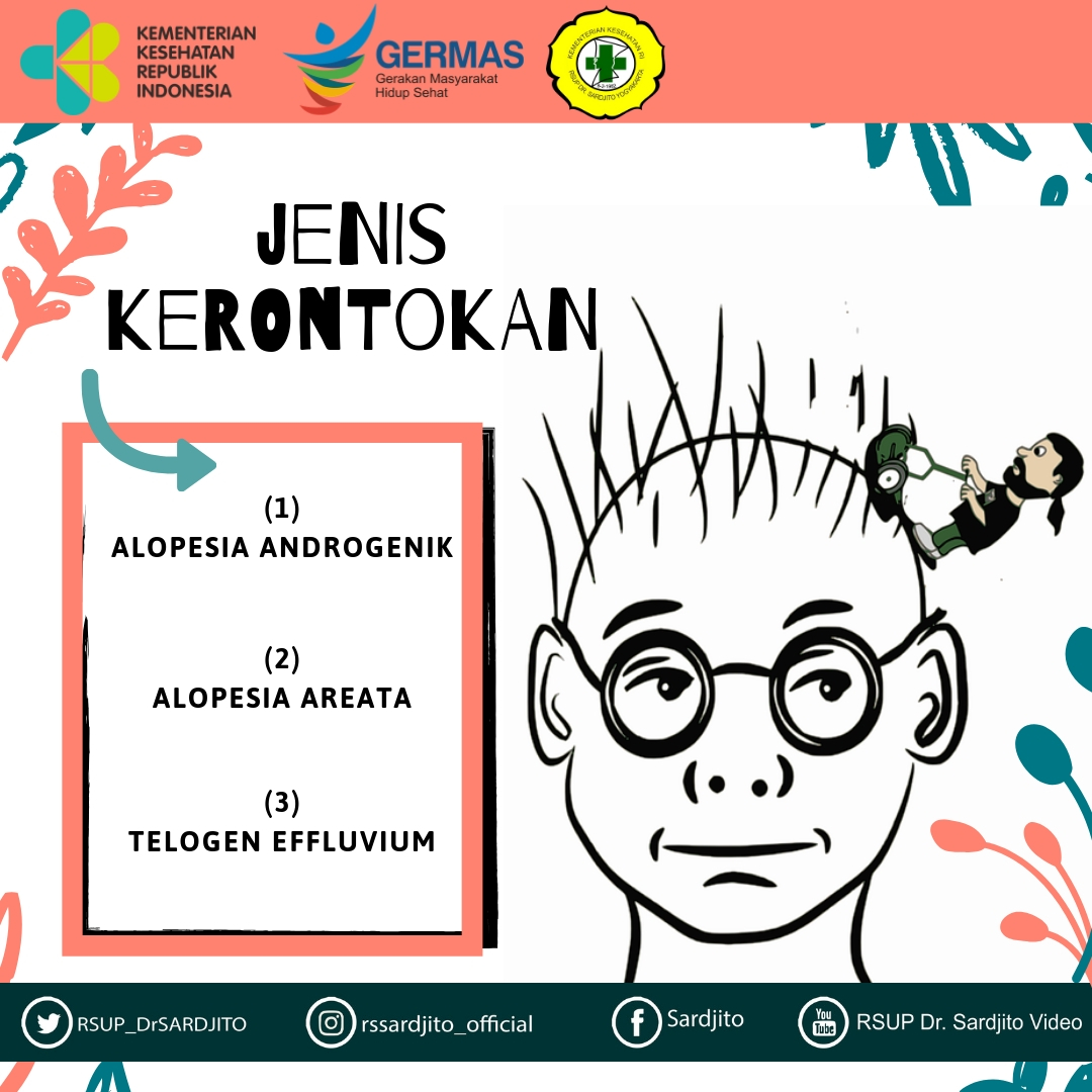 Mengenali Rambut Rontok dan Mencegah Kebotakan