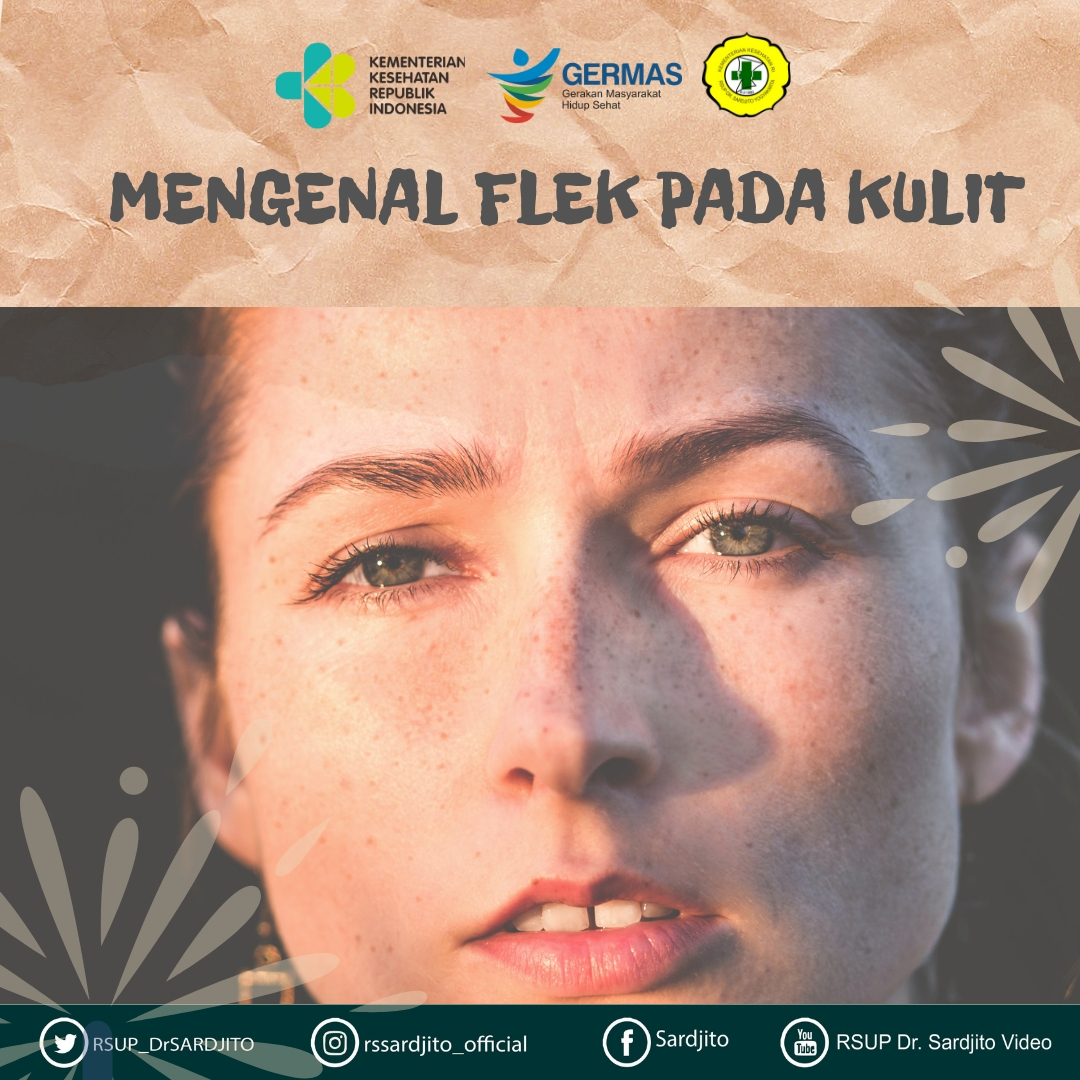 Mengenal Flek Pada Kulit