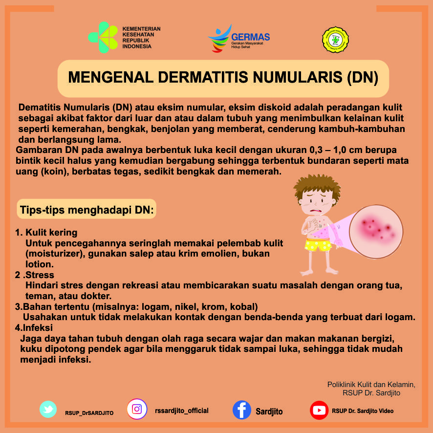 Mengenal Dermatitis Numularis (DN)