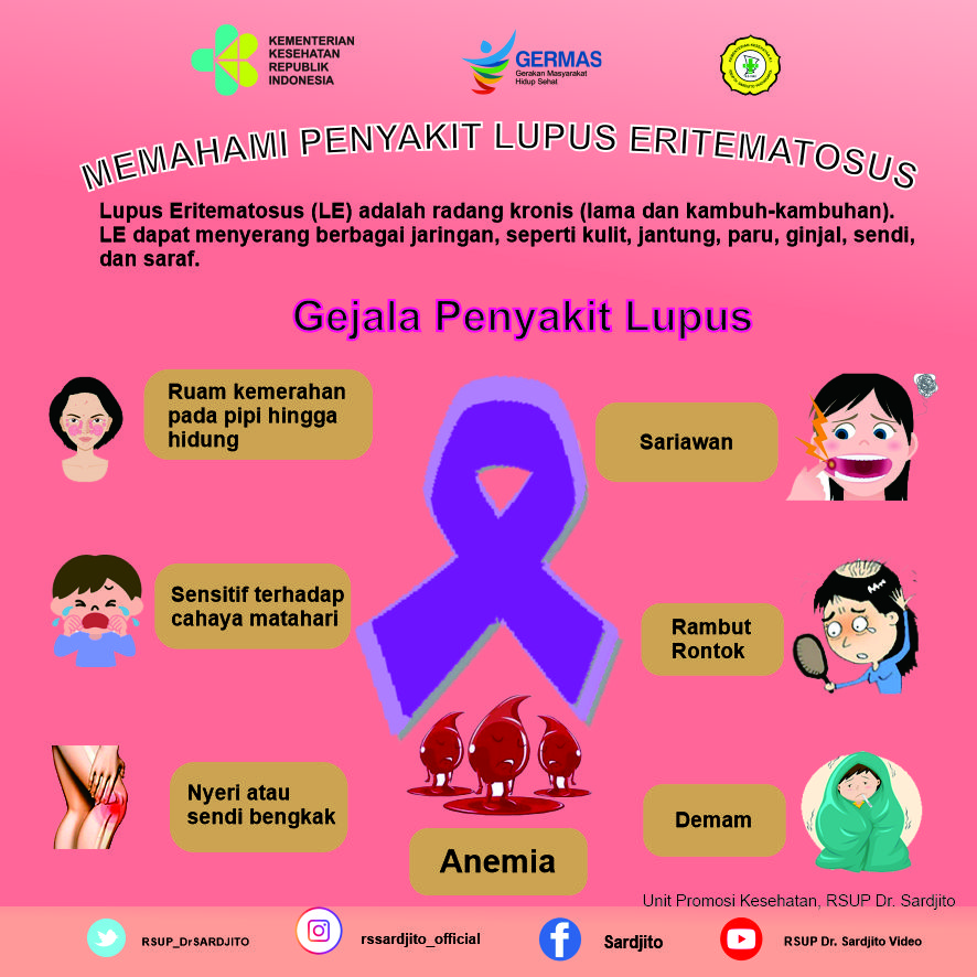 Memahami Penyakit Lupus Eritematosus