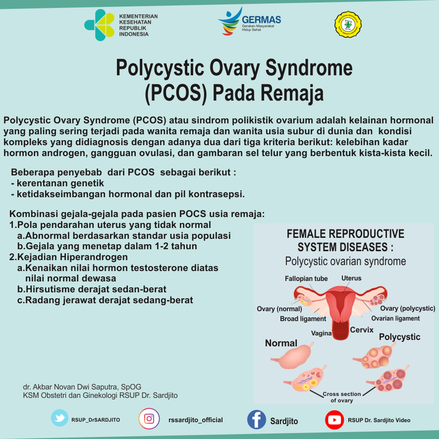 Polycystic Ovary Syndrome (PCOS) Pada Remaja