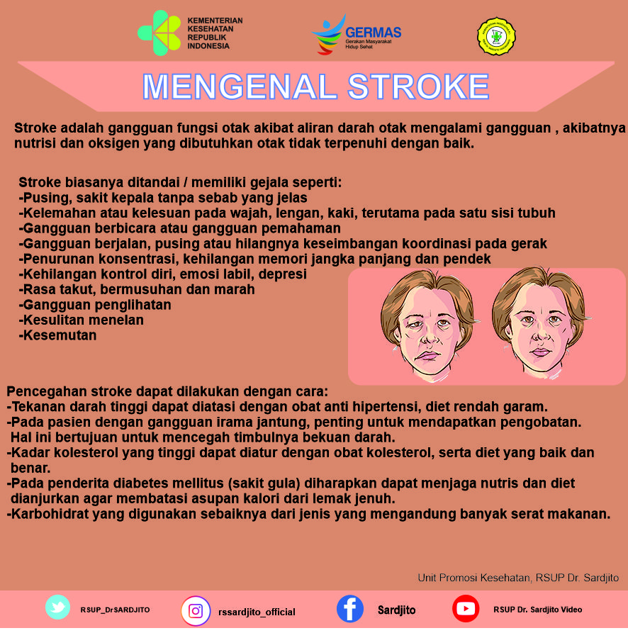 Mengenal Stroke