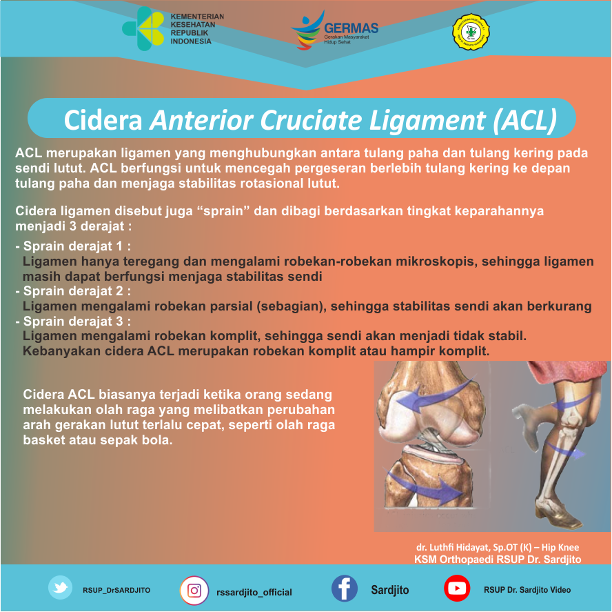 Cidera Anterior Cruciate Ligament (ACL)