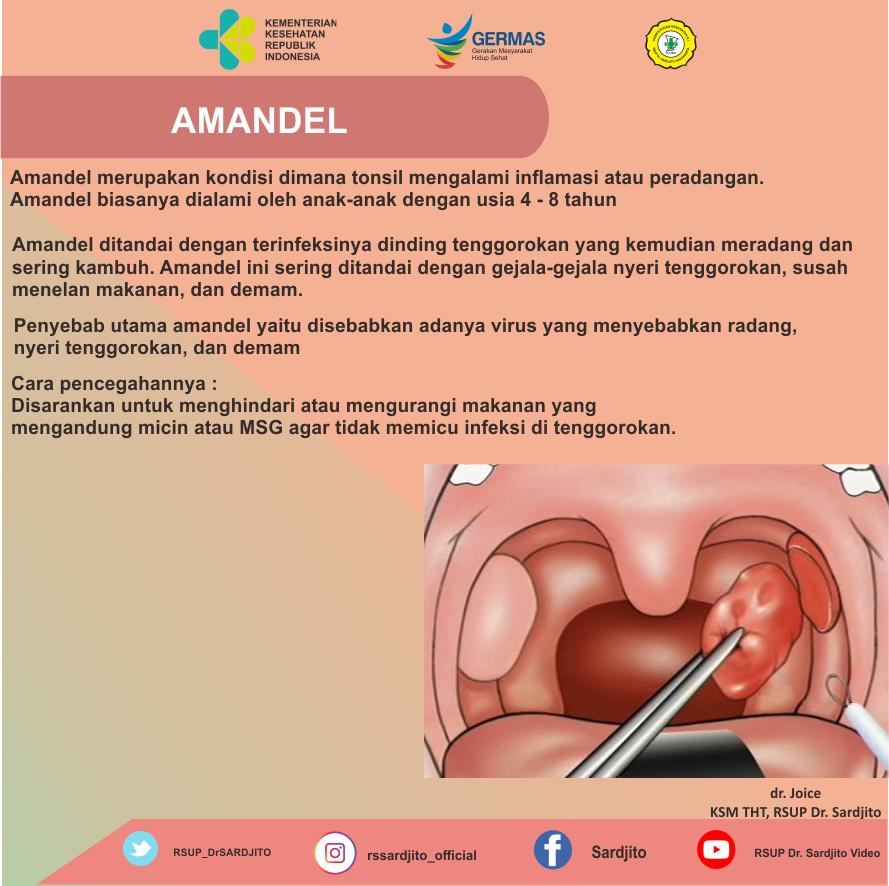 Amandel