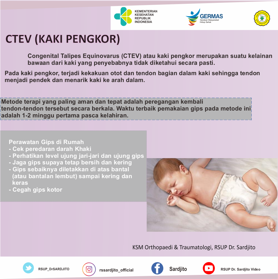 CTEV (KAKI PENGKOR)