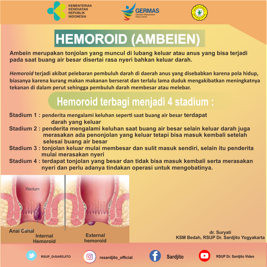 Hemoroid (Ambeien)
