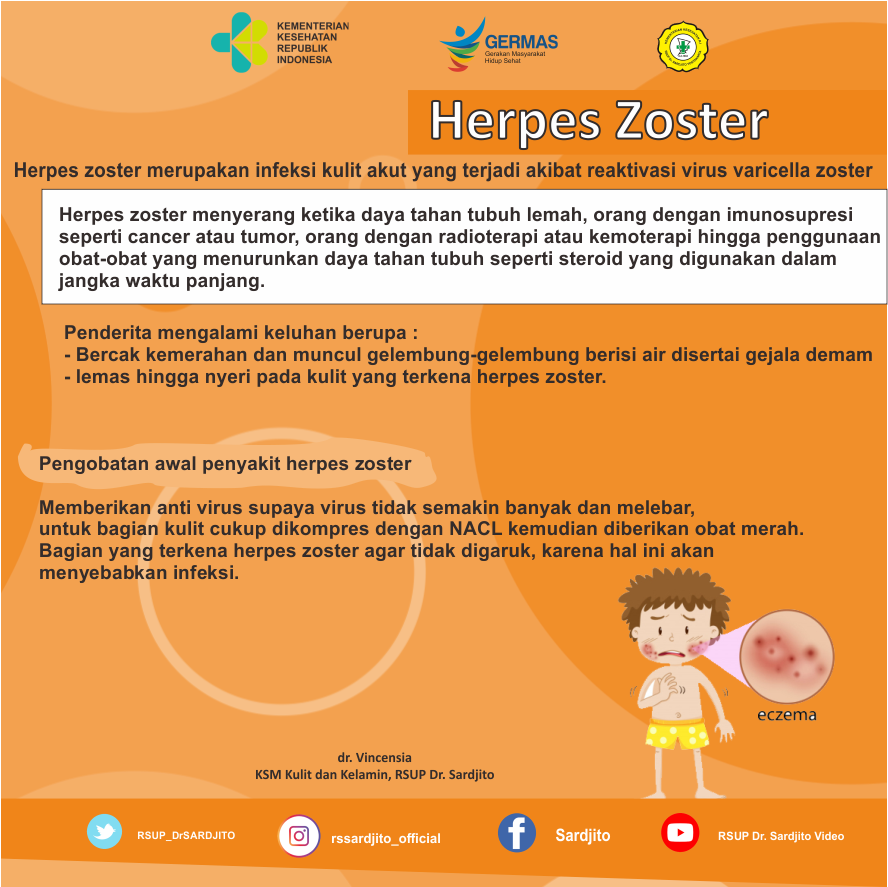 Herpes Zoster