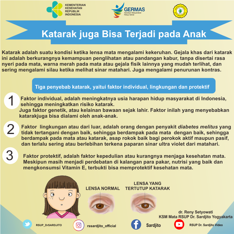Katarak juga Bisa Terjadi pada Anak