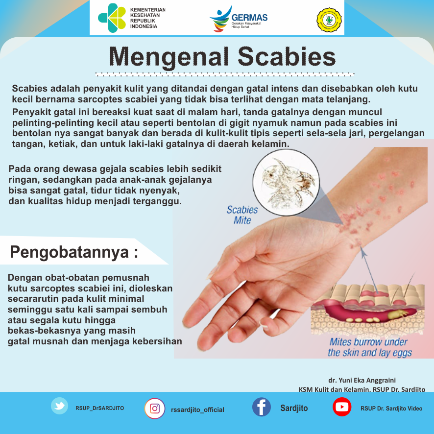 Mengenal Scabies