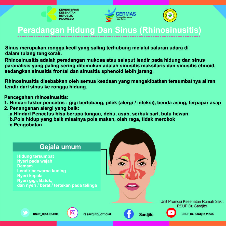 Peradangan Hidung Dan Sinus (Rhinosinusitis)