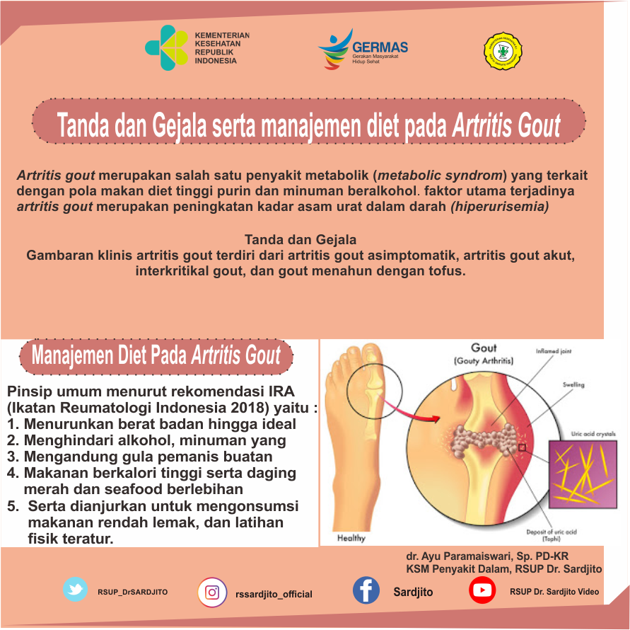Tanda dan Gejala serta Manajemen Diet pada Artritis Gout
