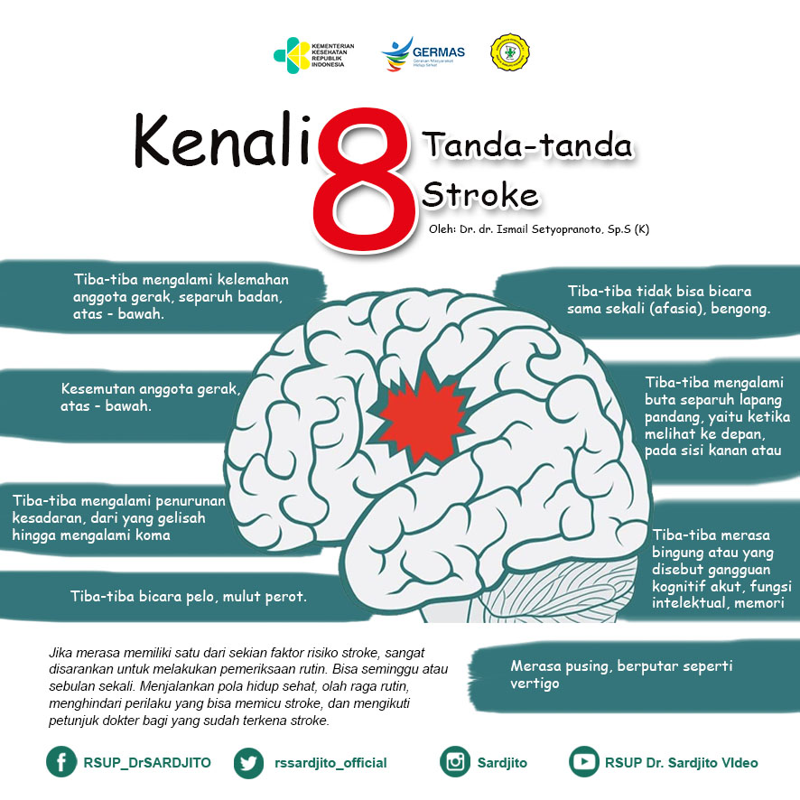 Kenali Delapan Tanda-tanda Stroke