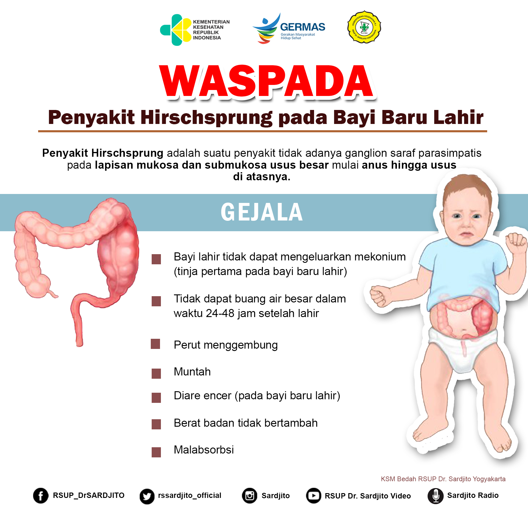 Waspada Penyakit Hirschsprung pada Bayi Baru Lahir