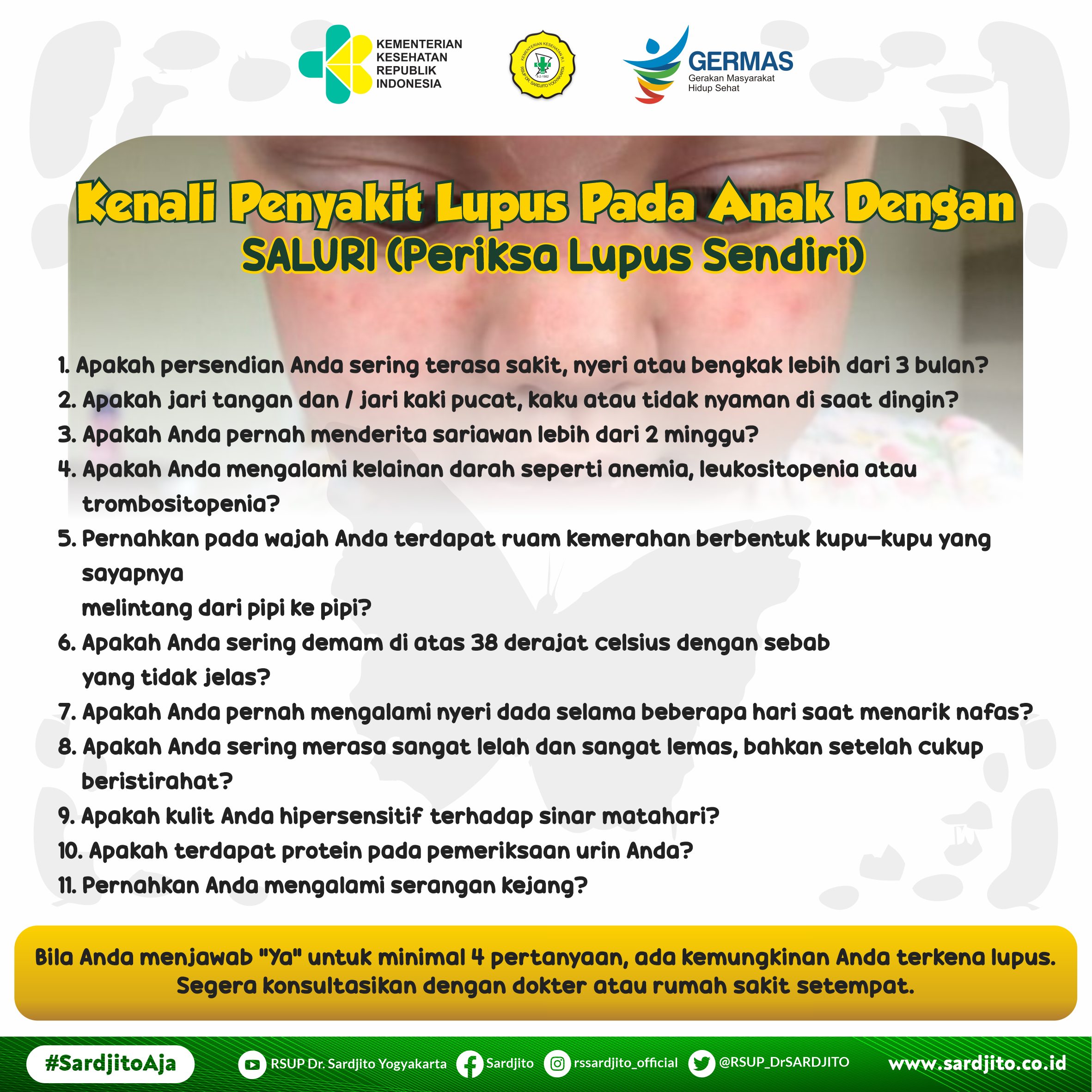 Kenali Penyakit Lupus Pada Anak Dengan SALURI (Periksa Lupus Sendiri)