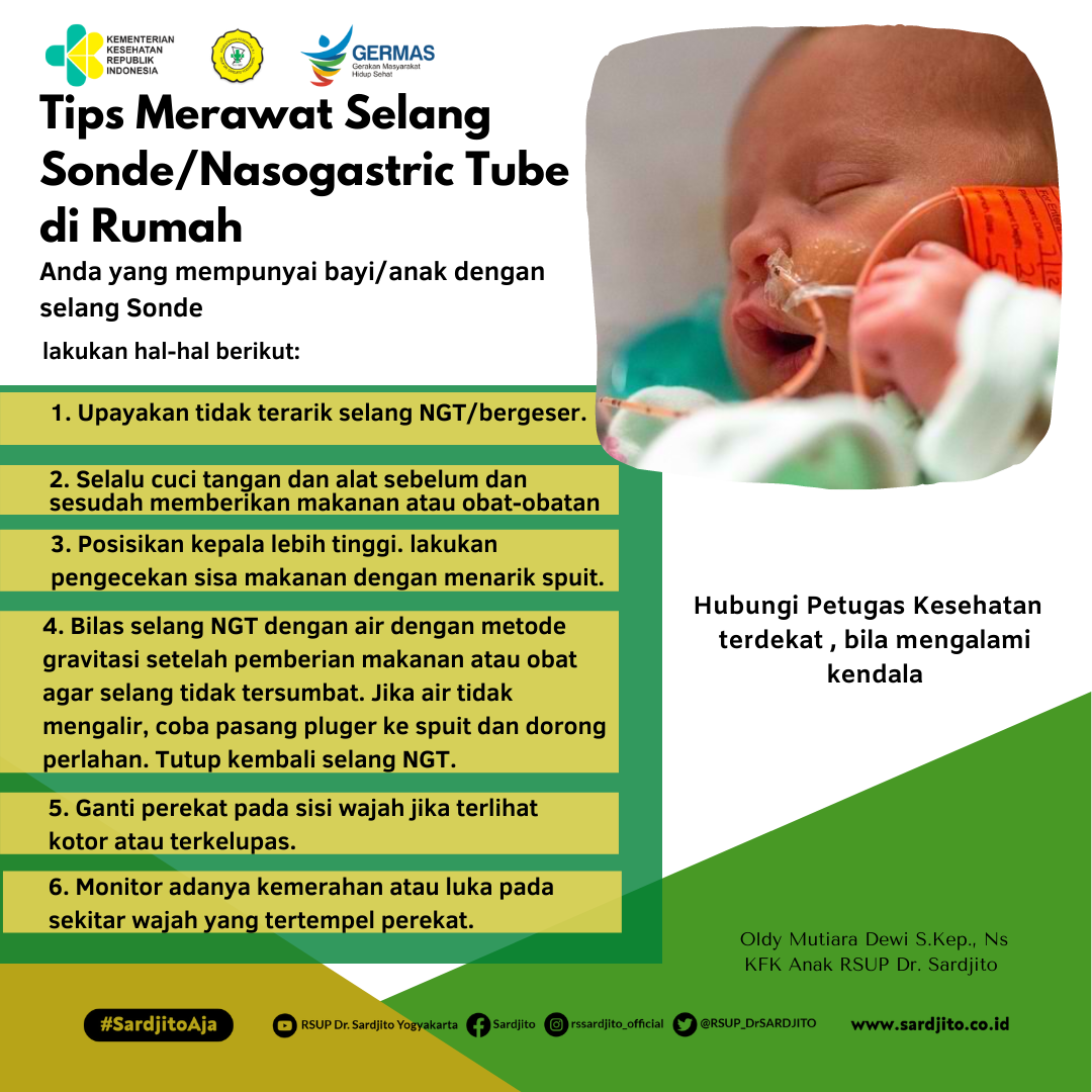 Tips Merawat Selang Sonde di Rumah