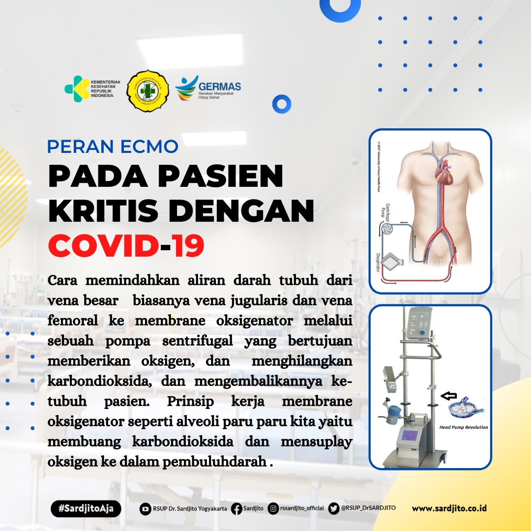 Peran ECMO pada Pasien Kritis dengan Covid-19