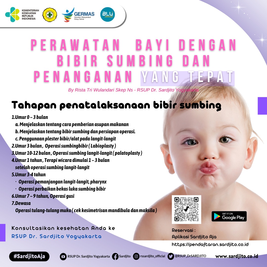 Merawat Bayi dengan Bibir Sumbing dan Penanganan yang Tepat