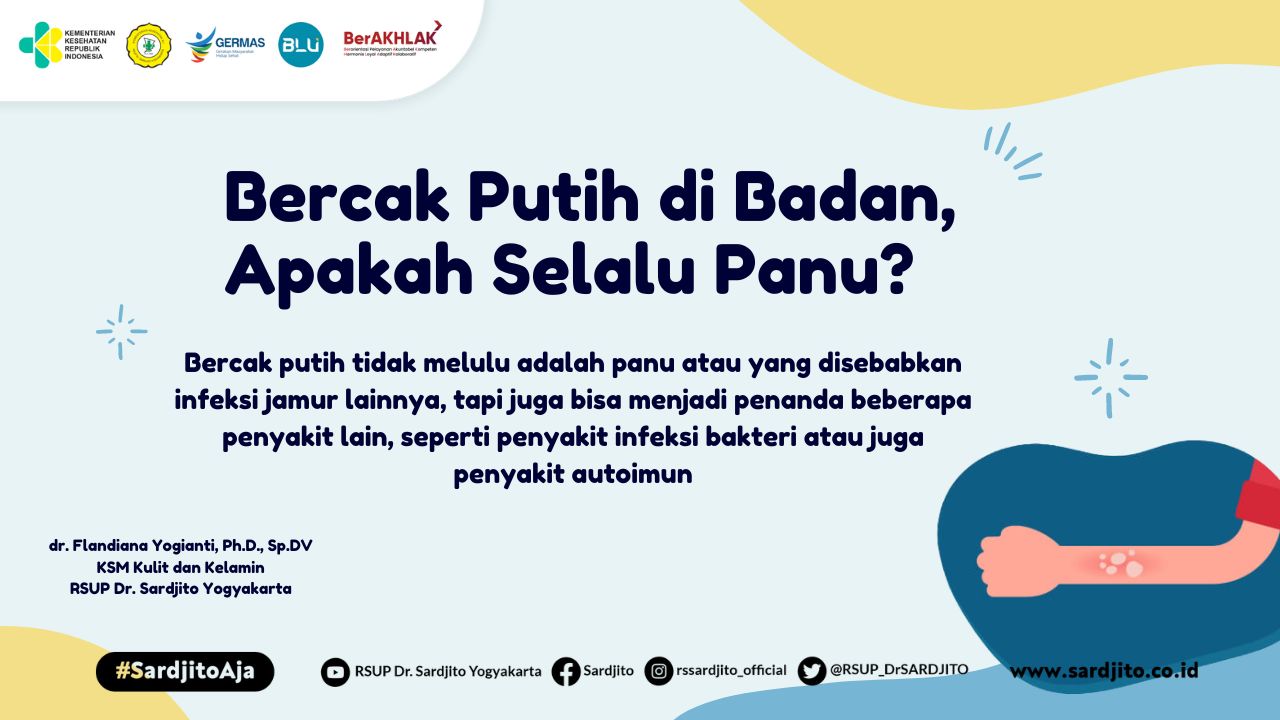 Bercak Putih di Badan, Apakah Selalu Panu?